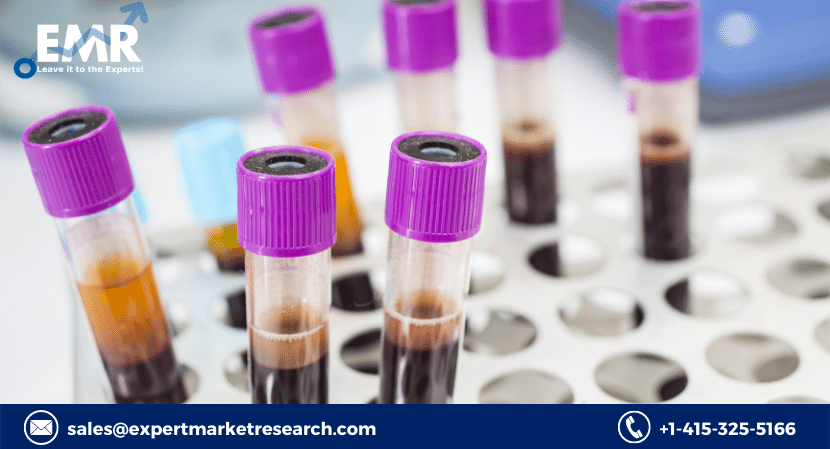 Global Blood Collection Market To Be Driven By Increasing Ailments And Need Of Diagnostic Tests During The Forecast Period Of 2023-2028